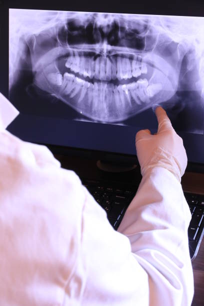 Best Dental Abscess Treatment in Richmond, MN