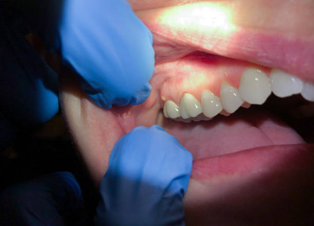 Best Emergency Treatment for Jaw Pain or Injury in Richmond, MN
